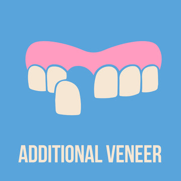 Additional Veneer from STL (Prime)