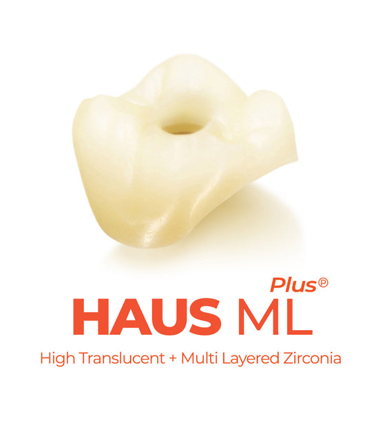 Multilayered Zirconia Implant Crown