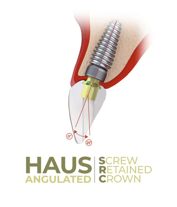 Angulated S.R.C.
