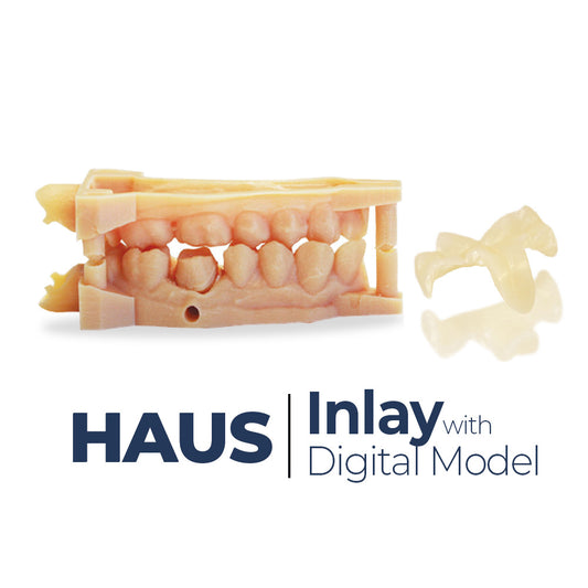 Haus Inlay with Digital Working Model