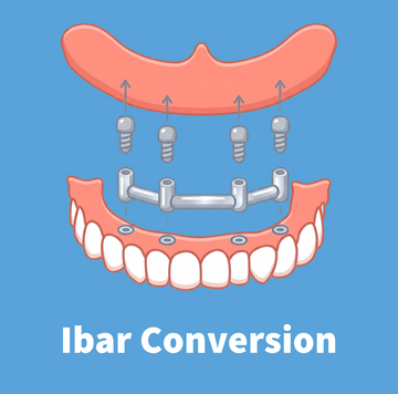 Ibar Conversion