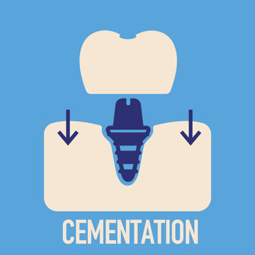Cementation
