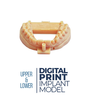 Digital Print Implant Model (Upper & Lower)